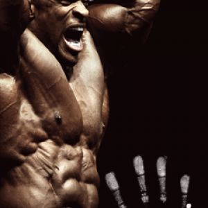 Ronnie Coleman Campeón de Culturismo