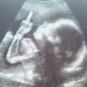 Imagen de ultrasonido divertida
