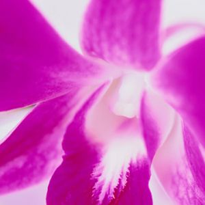 Orquídea Rosa Vibrante
